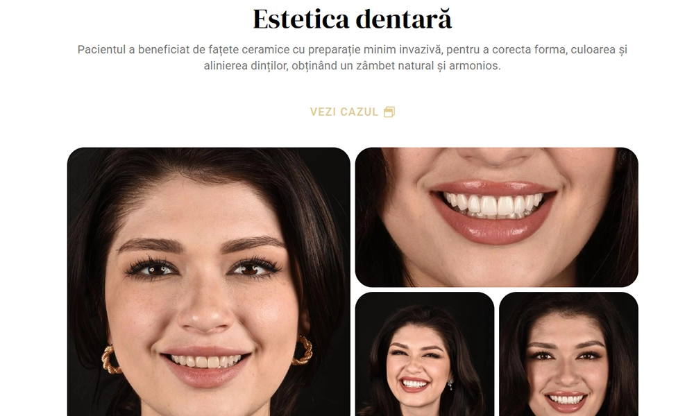 evi4